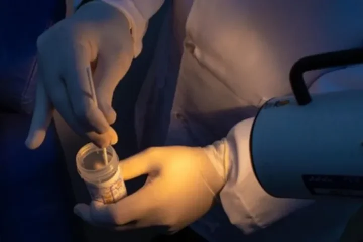 Foto: Detecção do DNA do HPV é mais prática e moderna que o conhecido Papanicola