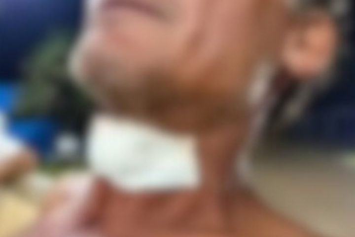 Foto: Vítima com curativo no pescoço após o atendimento no hospital. (Foto: Repr