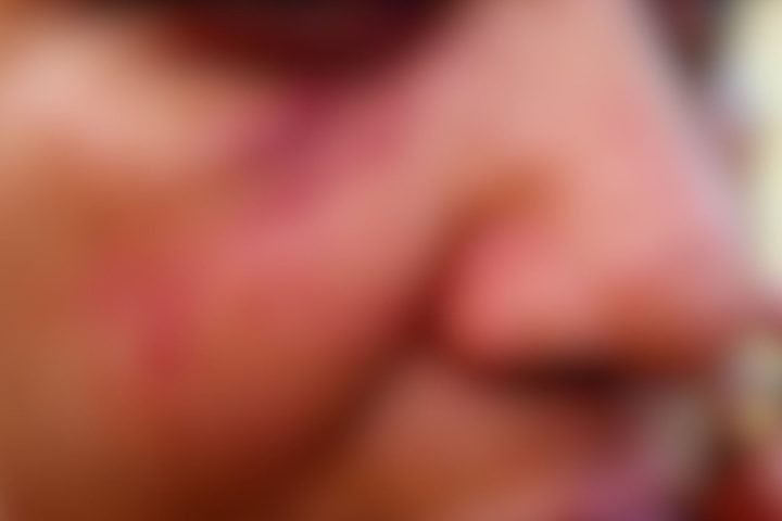 Vítima ficou com o olho roxo após as agressões. — Foto: Vítima ficou com o olho