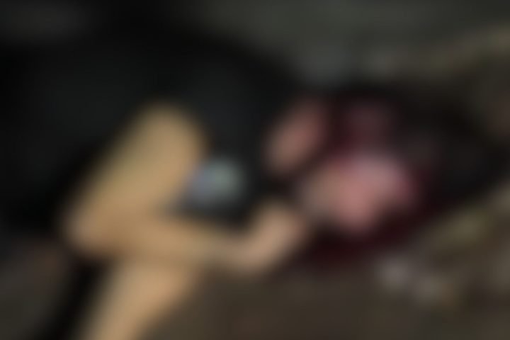 Foto: Vítima teria sofrido traumatismo craniano. (Foto: Leitor Midiamax)