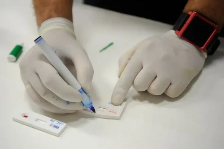 Teste de hepatite, foto ilustrativa — Foto: Teste de hepatite, foto ilustrativa
