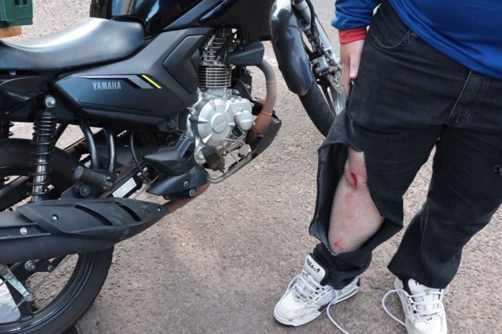 Foto: O motociclista apresentou escoriações no joelho. (Foto: Henrique Arakaki,