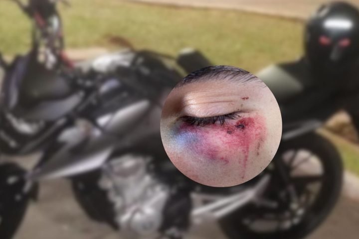 Foto: Motoentregador foi agredido por dois homens durante o assalto -Foto: Arqui
