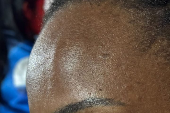 foto-5